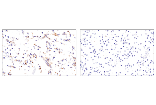 Immunohistochemistry Image 7: IGFBP7 (E3Z8L) Rabbit Monoclonal Antibody