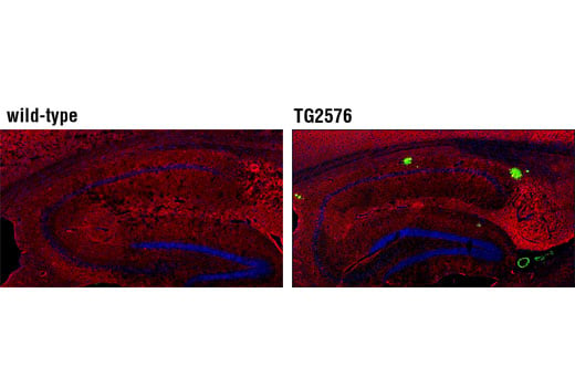 undefined Image 20: Pathological Hallmarks of Alzheimer's Disease Antibody Sampler Kit