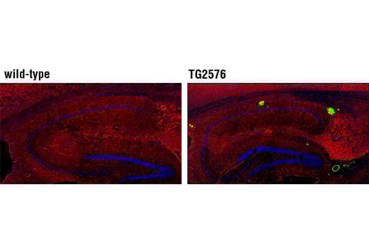 β-Amyloid (1-40) (D8Q7I) Rabbit mAb | Cell Signaling Technology