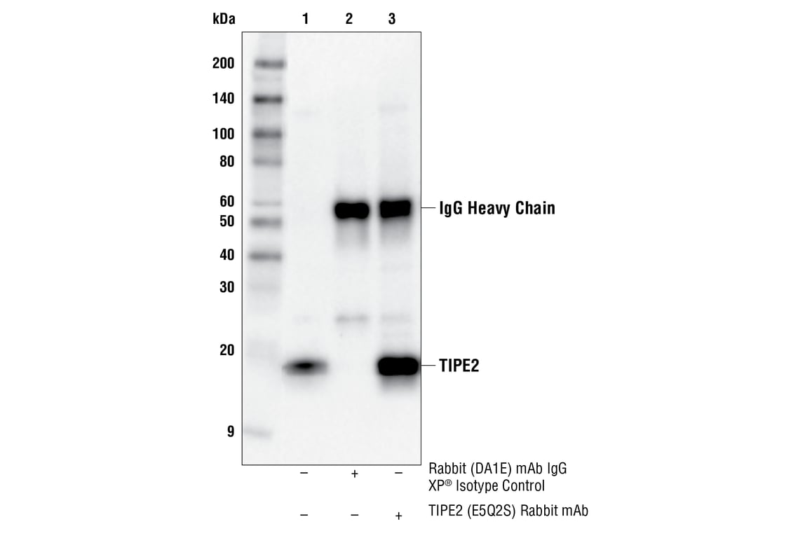 Immunoprecipitation Image 1: TIPE2 (E5Q2S) Rabbit Monoclonal Antibody