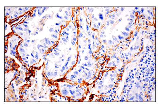 Immunohistochemistry Image 1: CD10/Neprilysin (E5P7S) Rabbit Monoclonal Antibody