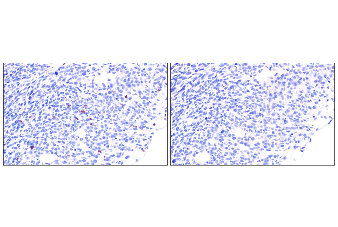 Immunohistochemistry Image 8: NCR1/NKp46 (F8M2L) Rabbit Monoclonal Antibody (IHC Formulated)