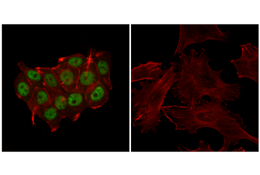 Immunofluorescence Image 1: Progesterone Receptor A/B (D8Q2J) Rabbit Monoclonal Antibody (BSA and Azide Free)