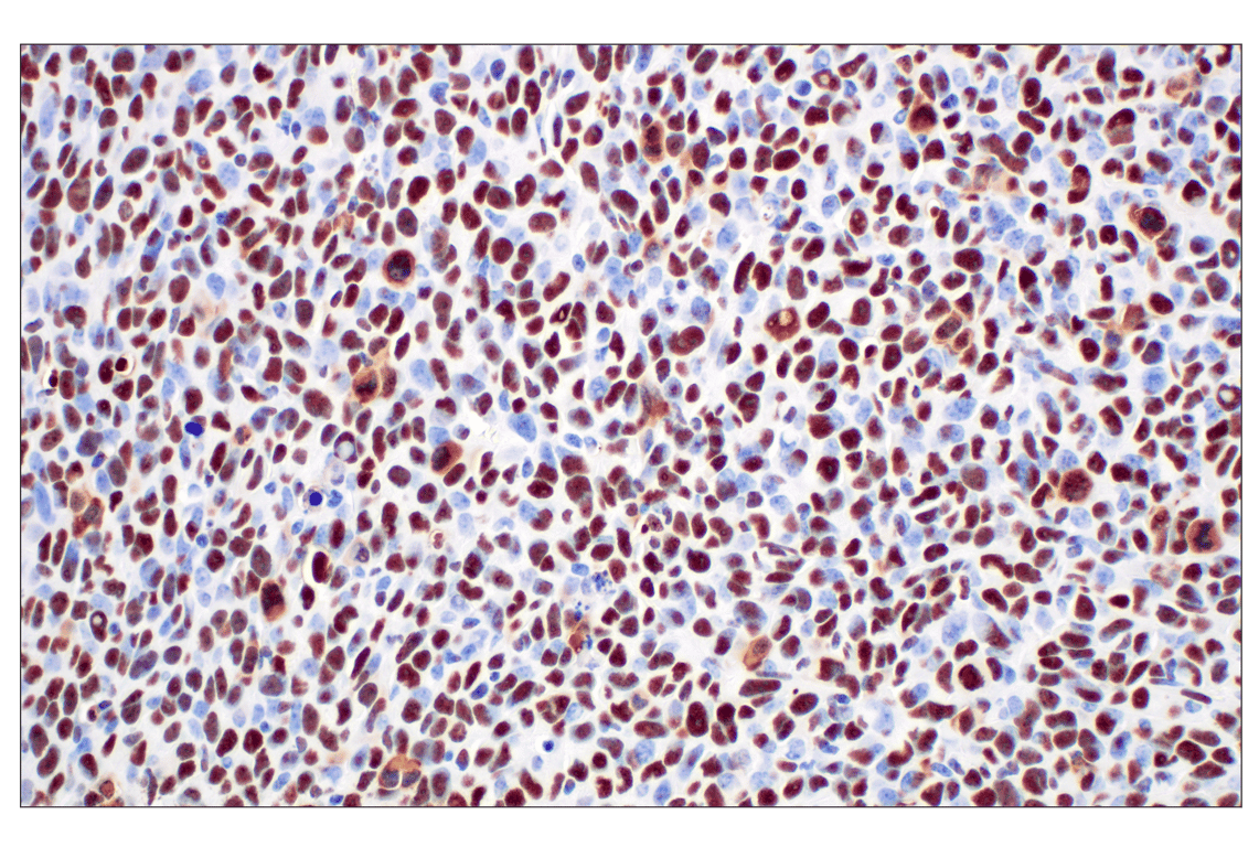 Immunohistochemistry Image 8: NPM1 (E7W4P) Rabbit Monoclonal Antibody