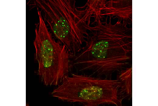 Immunofluorescence Image 1: ELL (D7N6U) Rabbit Monoclonal Antibody
