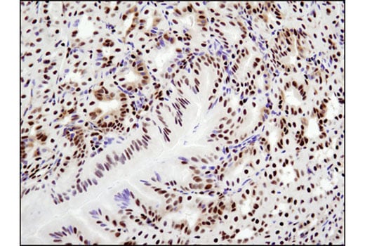 Immunohistochemistry Image 3: Glucocorticoid Receptor (D6H2L) Rabbit Monoclonal Antibody