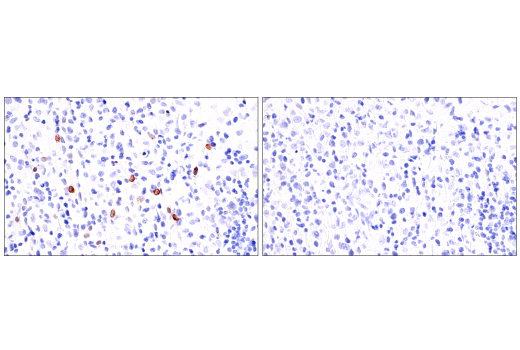 Immunohistochemistry Image 8: GNLY (E2T3D) Rabbit Monoclonal Antibody