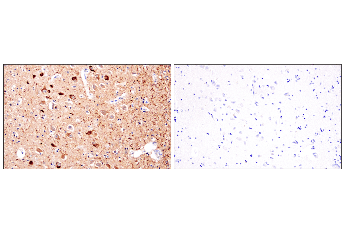 Immunohistochemistry Image 4: Phospho-Tau (Ser202) (F2A2F) Rabbit Monoclonal Antibody