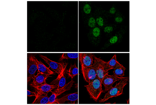 Immunofluorescence Image 1: HIF-2 alpha (E8E5Z) Rabbit Monoclonal Antibody