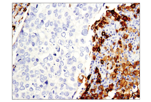 Immunohistochemistry Image 2: CD163 (D6U1J) Rabbit Monoclonal Antibody (BSA and Azide Free)