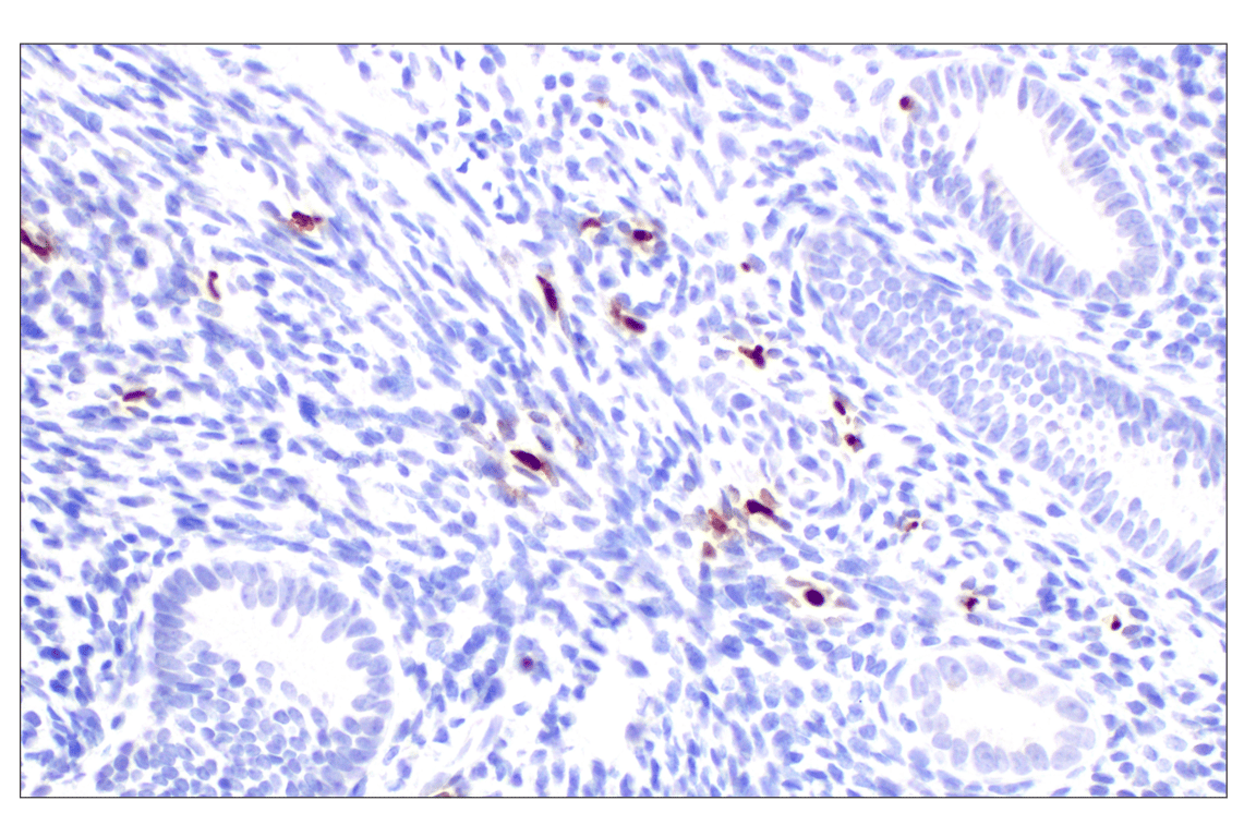 Immunohistochemistry Image 8: MNDA (3C1) Rat Monoclonal Antibody
