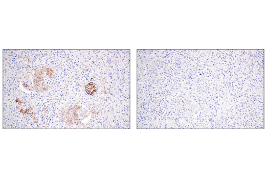 Immunohistochemistry Image 1: Enolase-2 (E2H9X) Rabbit Monoclonal Antibody