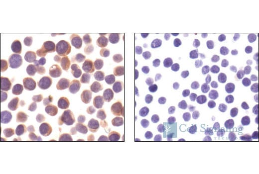 Immunohistochemistry Image 1: Zap-70 (99F2) Rabbit mAb