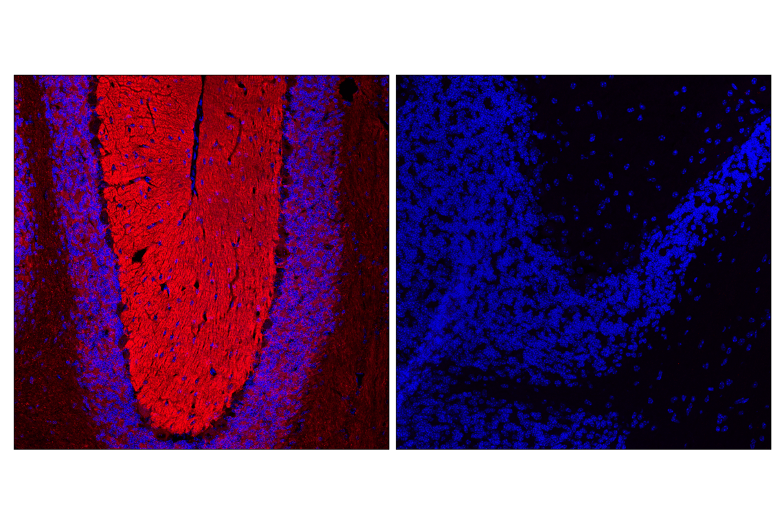 Immunofluorescence Image 1: Tau (E5O2W) Rabbit Monoclonal Antibody