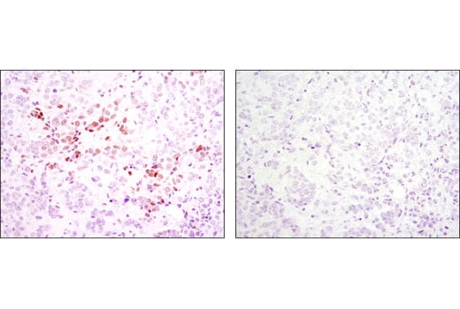 undefined Image 28: IRF Family Antibody Sampler Kit