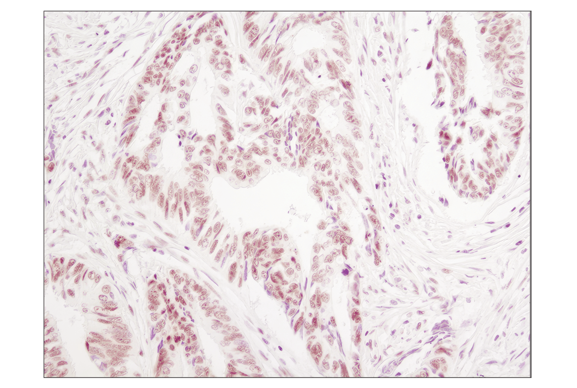 Immunohistochemistry Image 1: Phospho-p38 MAPK (Thr180/Tyr182) (D3F9) Rabbit Monoclonal Antibody