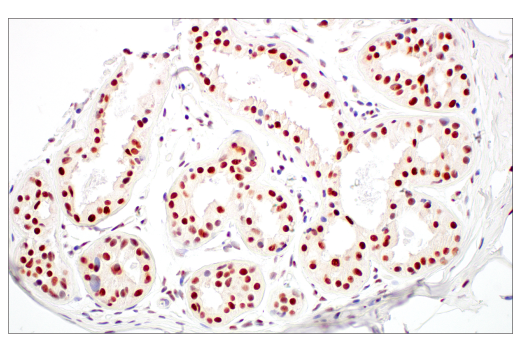 Immunohistochemistry Image 9: Rad50 (E4J5R) Rabbit Monoclonal Antibody