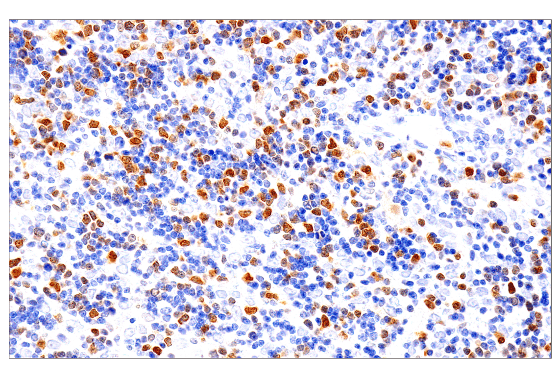 Immunohistochemistry Image 2: Chk1 (2G1D5) Mouse mAb