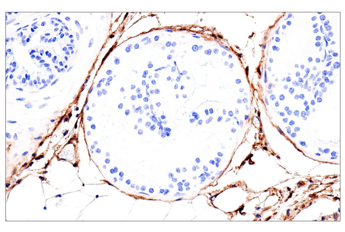 Immunohistochemistry Image 3: DPEP-1/MDP (E5H7T) Rabbit Monoclonal Antibody