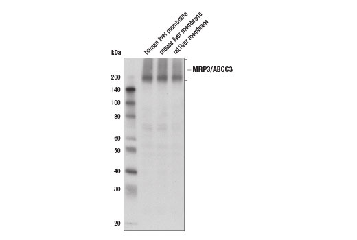 Western Blotting Image 2: MRP3/ABCC3 (D8V8J) Rabbit Monoclonal Antibody