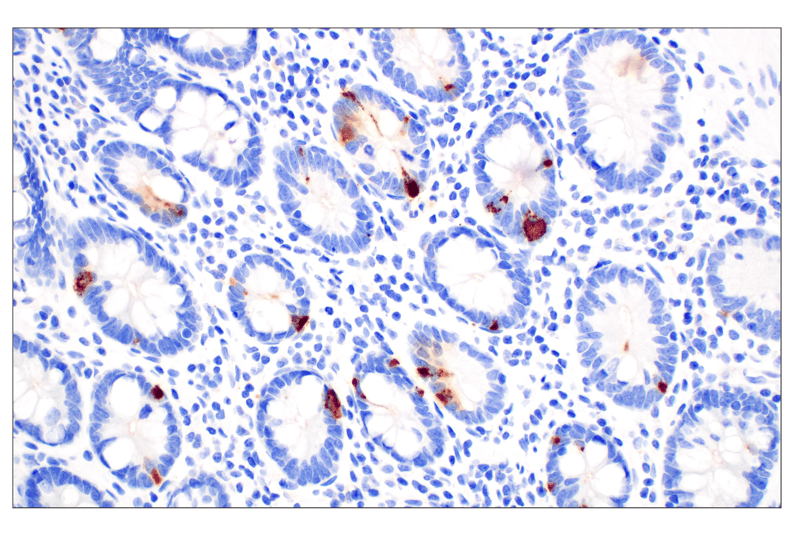 Immunohistochemistry Image 3: CHGA (F7D6H) Rabbit mAb