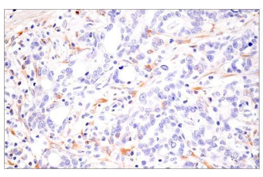 Immunohistochemistry Image 4: CTHRC1 (E8M9S) Rabbit Monoclonal Antibody