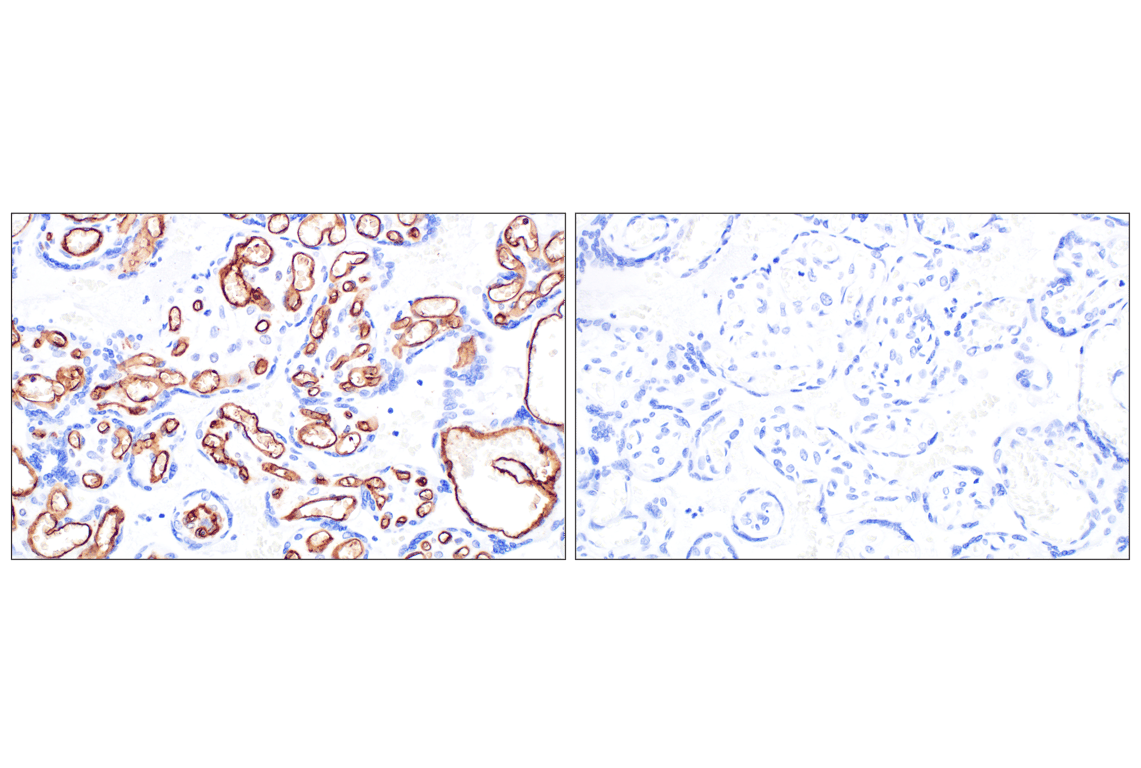 Immunohistochemistry Image 9: CD34 (QBEND/10) Mouse Monoclonal Antibody