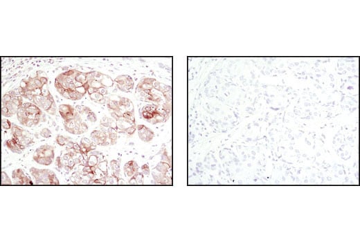 undefined Image 25: Alzheimer's Disease Antibody Sampler Kit
