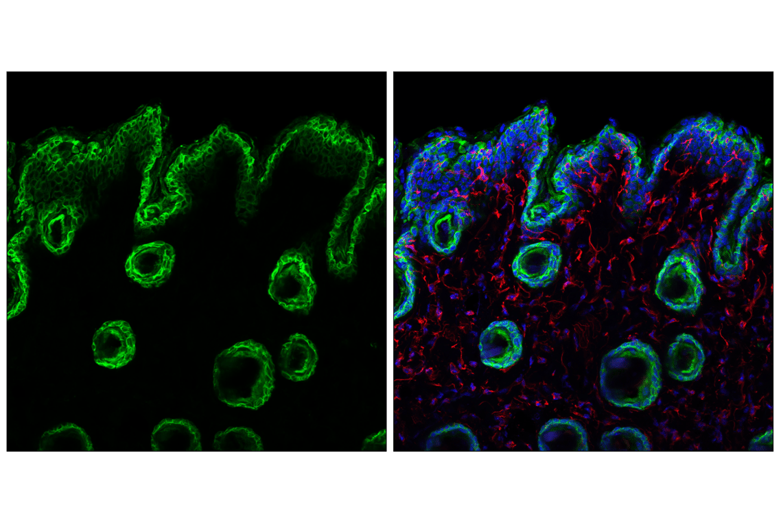 Immunofluorescence Image 1: Keratin 5 (E2T4B) Rabbit Monoclonal Antibody (Alexa Fluor<sup>®</sup> 488 Conjugate)