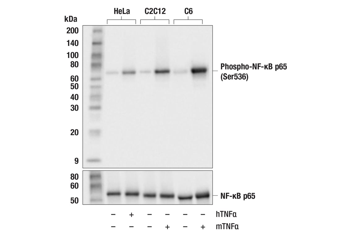 Western Blotting Image 3: Phospho-NF-kappaB p65 (Ser536) (93H1) Rabbit Monoclonal Antibody (Biotinylated)