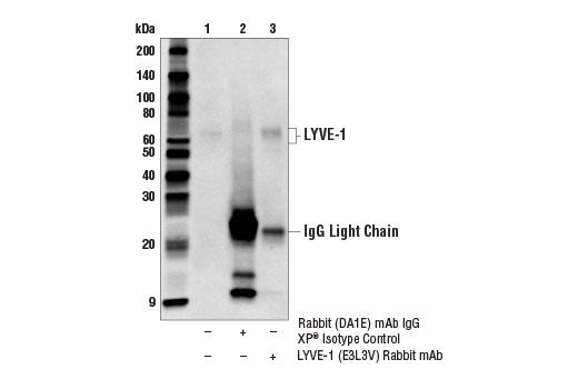 Immunoprecipitation Image 1: LYVE-1 (E3L3V) Rabbit Monoclonal Antibody