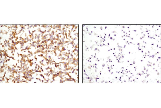 Immunohistochemistry Image 5: HER3/ErbB3 (D22C5) Rabbit Monoclonal Antibody
