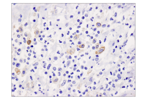 Immunohistochemistry Image 3: PD-L2 (D7U8C) Rabbit Monoclonal Antibody (BSA and Azide Free)