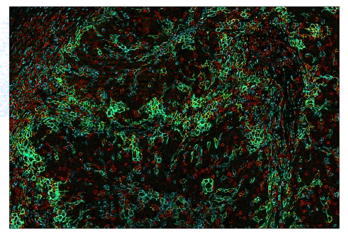 Immunohistochemistry Image 1: CD11c (D3V1E) & CO-0017-594 SignalStar<sup>™</sup> Oligo-Antibody Pair