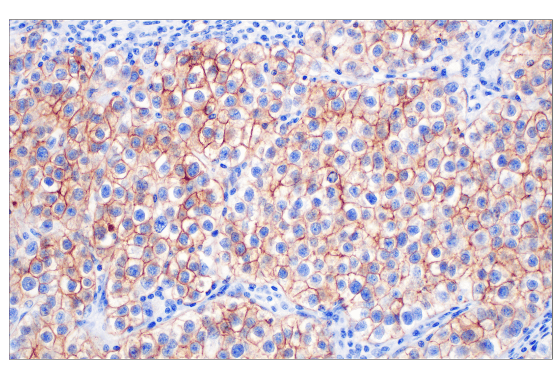 Immunohistochemistry Image 1: ALPP/ALPPL2 (F1L4G) Rabbit Monoclonal Antibody