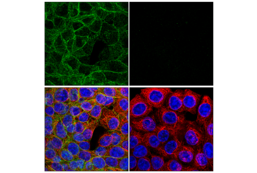 Immunofluorescence Image 1: CMTM6 (E6A8T) Rabbit Monoclonal Antibody