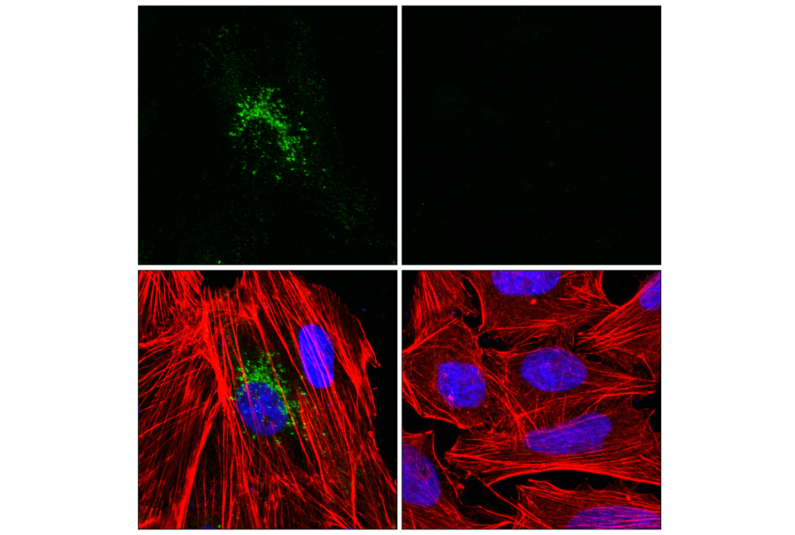 Immunofluorescence Image 1: CXCL6 (E6V8D) Rabbit Monoclonal Antibody