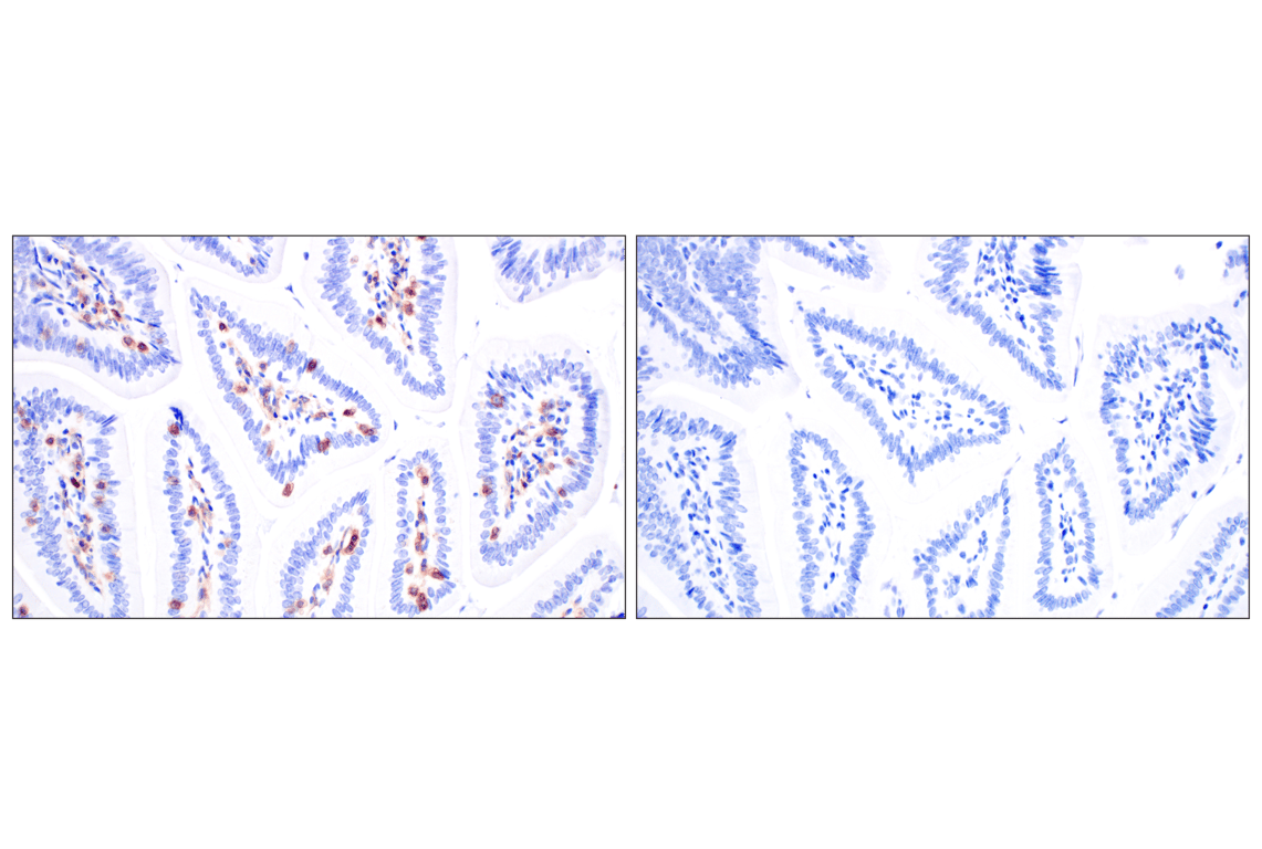 Immunohistochemistry Image 9: DAP12 (F1Q2P) Rabbit Monoclonal Antibody