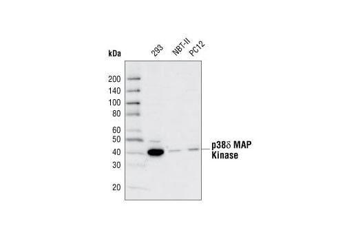 Western Blotting Image 2: p38 delta MAPK (10A8) Rabbit Monoclonal Antibody