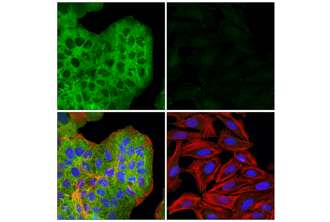 Immunofluorescence Image 1: Liprin alpha1 (E7D7W) Rabbit Monoclonal Antibody
