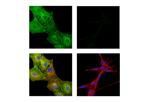Immunofluorescence Image 1: Myelin Protein Zero Antibody