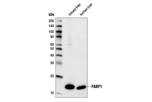 Western Blotting Image 2: FABP1 (D2A3X) Rabbit Monoclonal Antibody