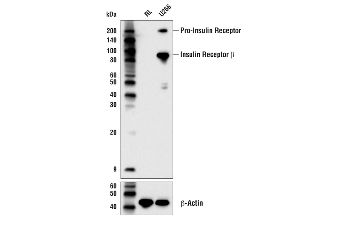 Western Blotting Image 2: Insulin Receptor β (E9L5V) XP<sup>®</sup> Rabbit mAb (BSA and Azide Free)