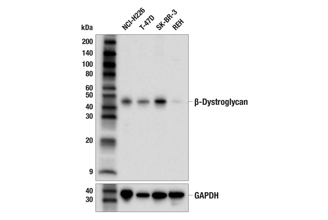 Western Blotting Image 2: β-Dystroglycan (E3Z8H) Rabbit mAb