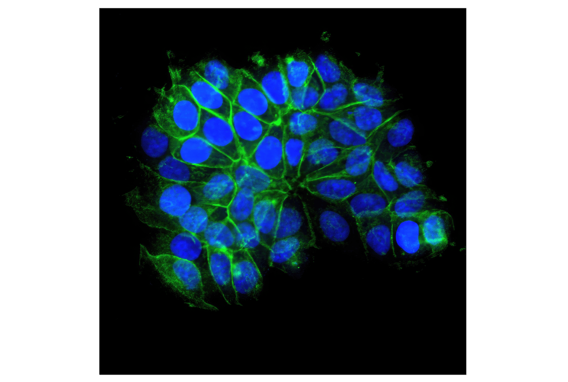 Immunofluorescence Image 1: E-Cadherin (24E10) Rabbit Monoclonal Antibody (Alexa Fluor<sup>®</sup> 488 Conjugate)