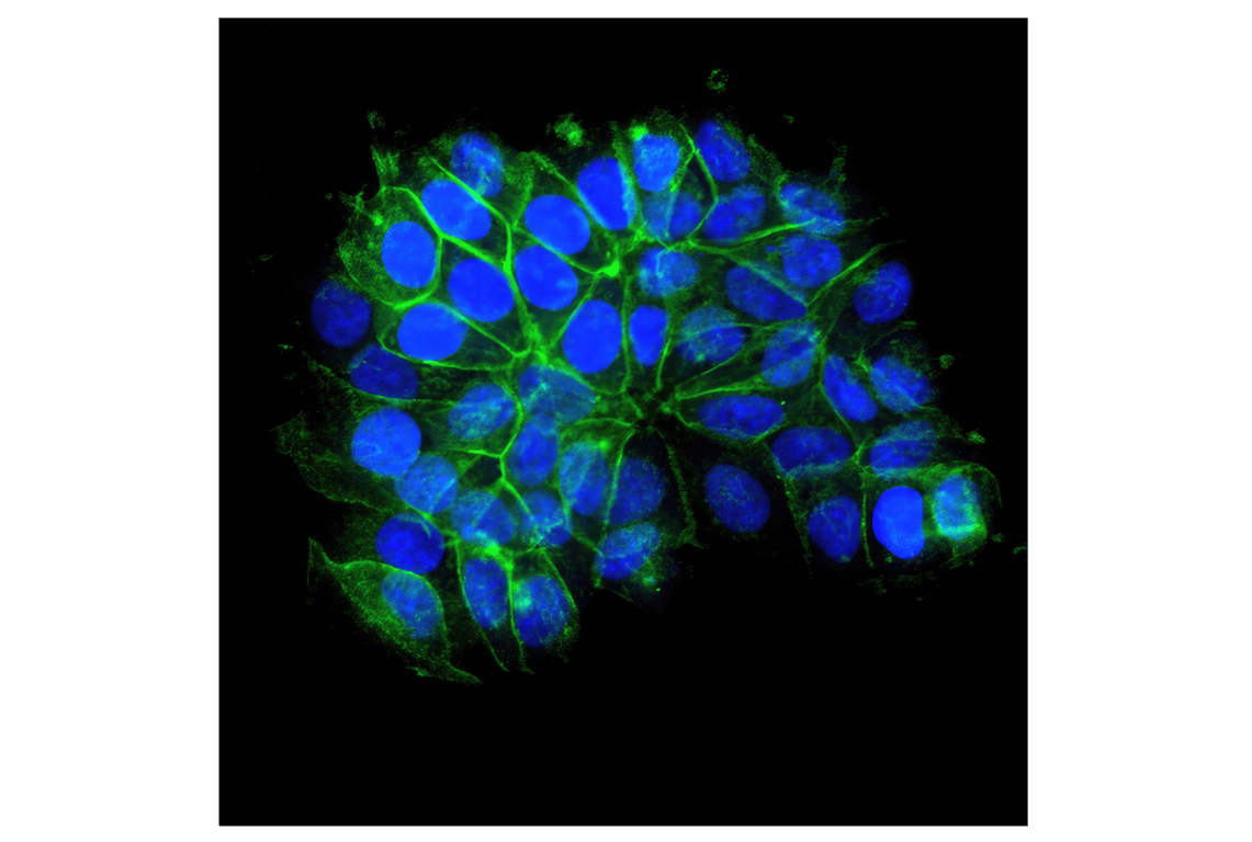 Immunofluorescence Image 1: E-Cadherin (24E10) Rabbit mAb (Alexa Fluor<sup>®</sup> 488 Conjugate)