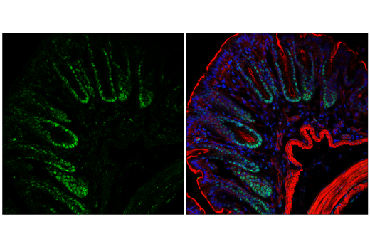 Immunofluorescence Image 1: NSUN2 (E6N6I) Rabbit Monoclonal Antibody