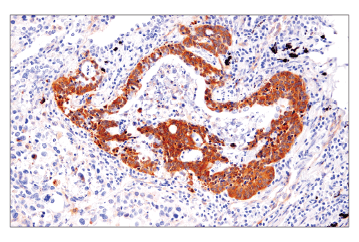 Immunohistochemistry Image 3: LC3B (E5Q2K) Mouse Monoclonal Antibody (BSA and Azide Free)