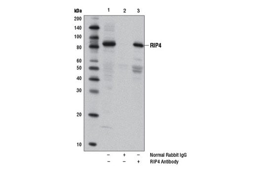 Immunoprecipitation Image 1: RIP4 Antibody