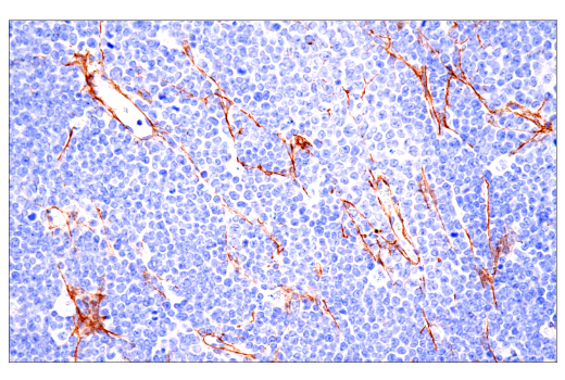Immunohistochemistry Image 4: COL1A1 (E8F4L) Rabbit Monoclonal Antibody